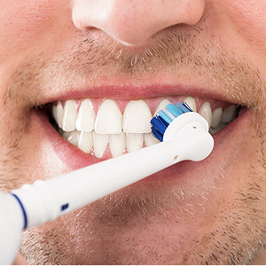 Keeping up Good Hygiene Still a Necessity with Dental Implants