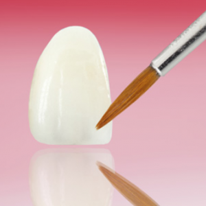 Transform Your Smile With Porcelain Veneers - Woo Wang Dental