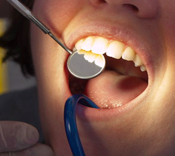 Even if a Root Canal Won’t Work, This Procedure Could Save your Tooth